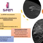 Formation en tomosynthèse sur consoles