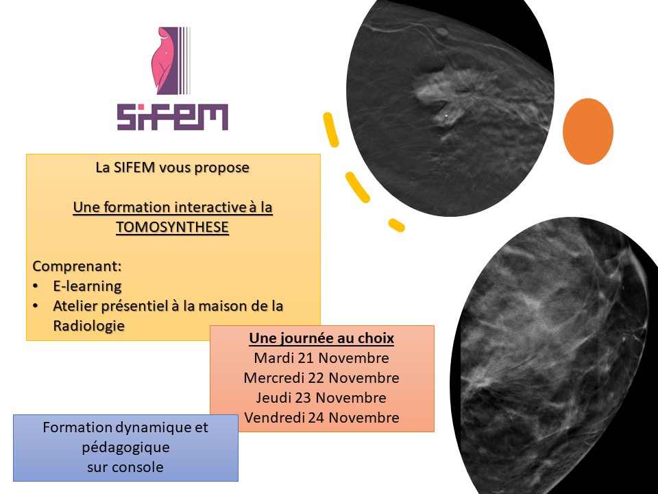 Formation en tomosynthèse sur consoles