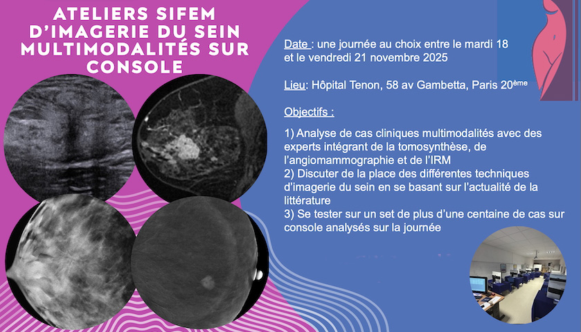 Ateliers SIFEM d’imagerie du sein mulimodalités sur console