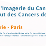 Journée d&rsquo;imagerie du Cancer de l&rsquo;Institut des Cancers des Femmes